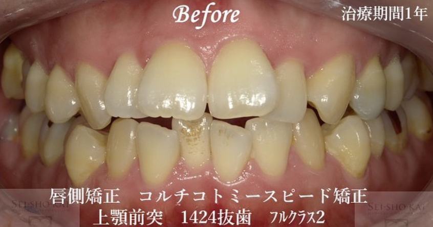 治療前